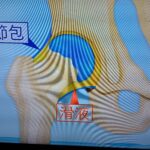 Thumbnail of related posts 139