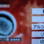 Thumbnail of related posts 171